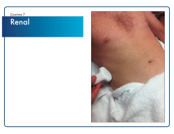 Chapter 7 Renal