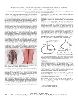prediction of spinal deformity in scoliosis from torso surface cross