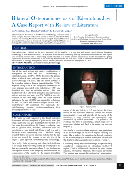 Bilateral Osteoradionecrosis of Edentulous Jaw: A Case