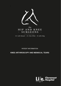 Knee arthroscopy patient information