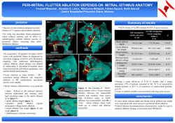 Peri-mitral flutter ablation depends on mitral isthmus anatomy
