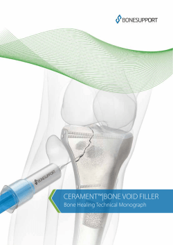 cerament&trade;|bone void filler
