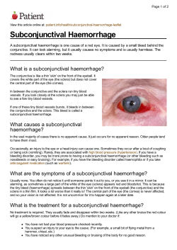 Subconjunctival Haemorrhage