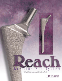 Reach&reg; Revision Hip System