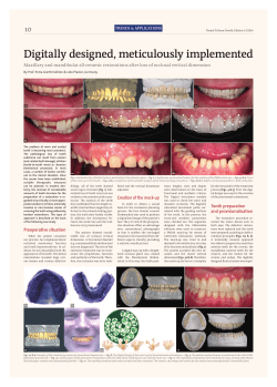 Digitally designed, meticulously implemented