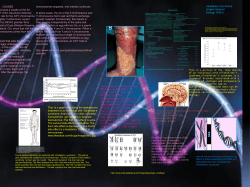 Kleinfelter`s Syndrome