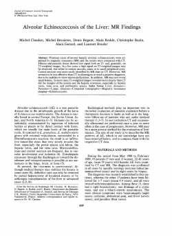 Alveolar-Echinococco..