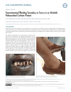 Gastrointestinal Bleeding Secondary to Scurvy in an Alcoholic