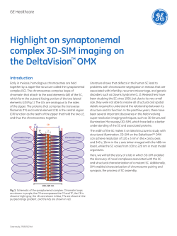 Highlight on synaptonemal complex 3D