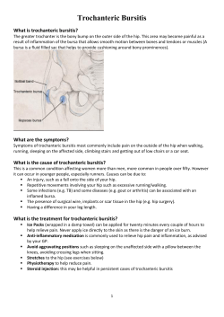 Trochanteric Bursitis - Beauchamp House Surgery
