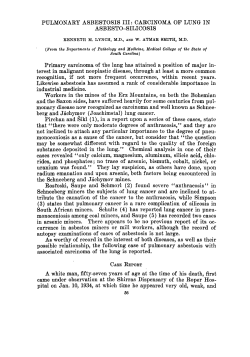 PULMONARY ASBESTOSIS 111: CARCINOMA OF LUNG IN