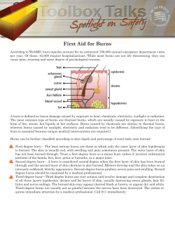 First Aid for Burns - National Utility Contractors Association