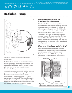 Baclofen pump - Intermountain Healthcare