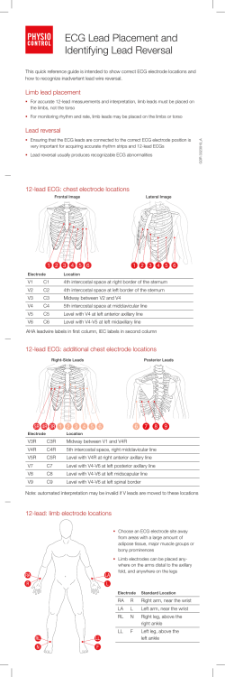 ECG Lead Placement and Identifying Lead Reversal
