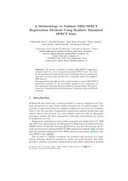 A Methodology to Validate MRI/SPECT Registration Methods Using