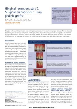 Gingival recession: part 2. Surgical management using