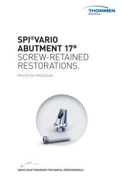spi®vario abutment 17° screw-retained restorations.