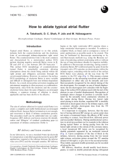 How to ablate typical atrial flutter
