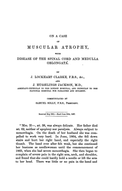 On a case of muscular atrophy, with disease of the spinal cord and
