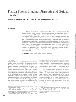 Plantar Fascia: Imaging Diagnosis and Guided Treatment