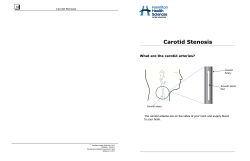 Carotid Stenosis - Hamilton Health Sciences