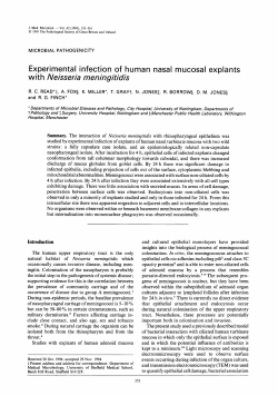Experimental infection of human nasal mucosal explants with