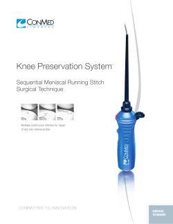 Knee Preservation System&trade;