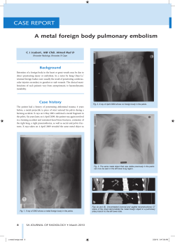 CASE REPORT CASE R A metal foreign body pulmonary embolism