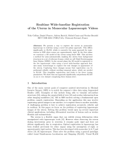 Realtime Wide-baseline Registration of the Uterus in