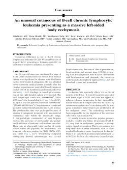 An unusual cutaneous of B-cell chronic lymphocytic leukemia