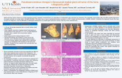Pseudosarcomatous changes in Denosumab treated giant cell
