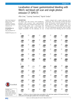 Localisation of lower gastrointestinal bleeding with 99mTc red blood