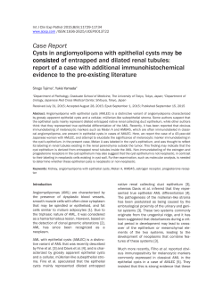 Case Report Cysts in angiomyolipoma with epithelial cysts may be