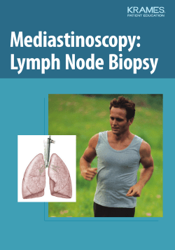 Mediastinoscopy: Lymph Node Biopsy