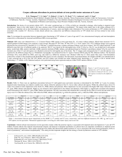 Corpus callosum alterations in preterm infants at term