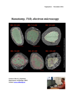 Nanotomy, T1D, electron microscopy