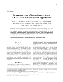 Leiomyosarcoma of the Abdominal Aorta: A Rare Cause of