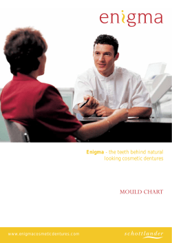 Enigma Mould Chart