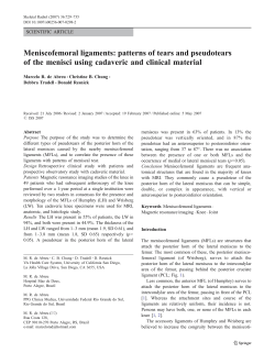 Meniscofemoral ligaments - Curso de Radiologia e Resid&ecirc;ncia em