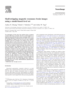 Skull-stripping magnetic resonance brain images - CCB