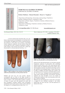 SUBUNGUAL GLOMUS TUMOUR Rohini Mathias1, Sharad
