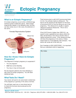 Ectopic Pregnancy