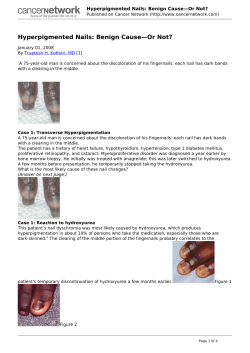 Hyperpigmented Nails: Benign Cause&mdash;Or Not?