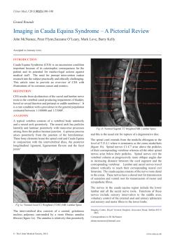 Imaging in Cauda Equina Syndrome &ndash; A Pictorial Review