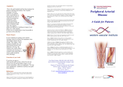 Peripheral Arterial Disease