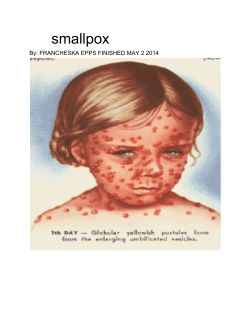 smallpox