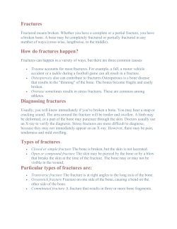Fractures How do fractures happen? Diagnosing fractures Types of