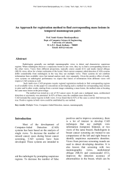 An Approach for registration method to find corresponding mass