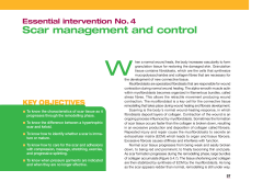 Essential intervention No.4 Scar management and control KEY