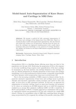 Model-based Auto-Segmentation of Knee Bones and Cartilage in